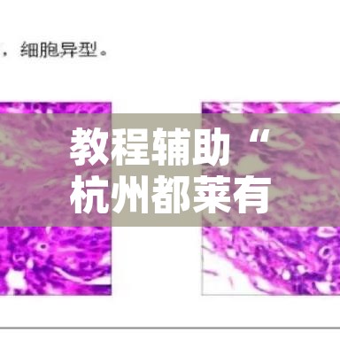教程辅助“杭州都莱有挂吗”其实确实有挂